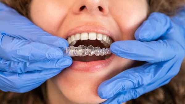Invisalign Fareham